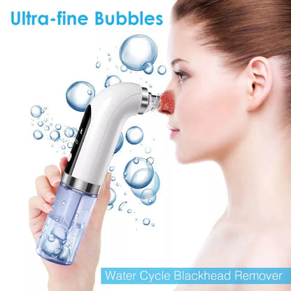 Hydrodermabrasion – Facial Cleaner and Vacuum